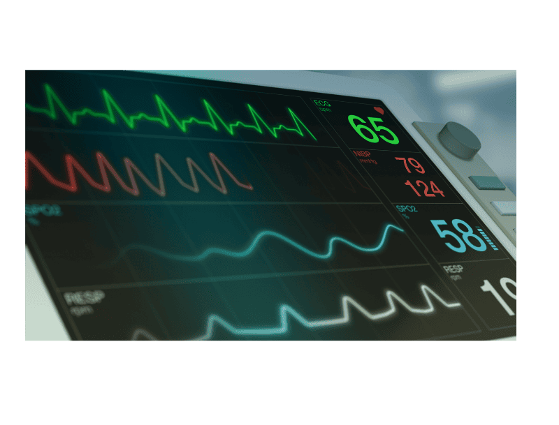 decorative image of ekg , PSC proposes new testing fees for EKG and Phlebotomy programs 2022-11-22 09:38:07